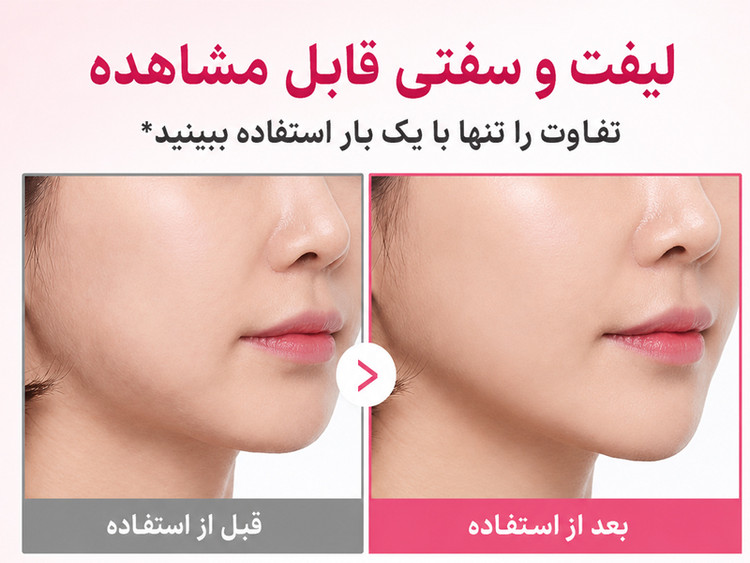 کرم ضد چروک گردن کلاژن PDRN گواشا مدی کیوب( جدیدترین محصول مدی کیوب✨)