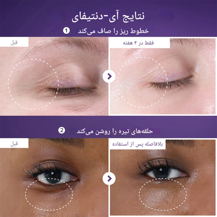 کرم دور چشم نامبوزین حاوی NAD+ رتینال و ۵۰ نوع پپتاید ضد چروک ۲۰ میل