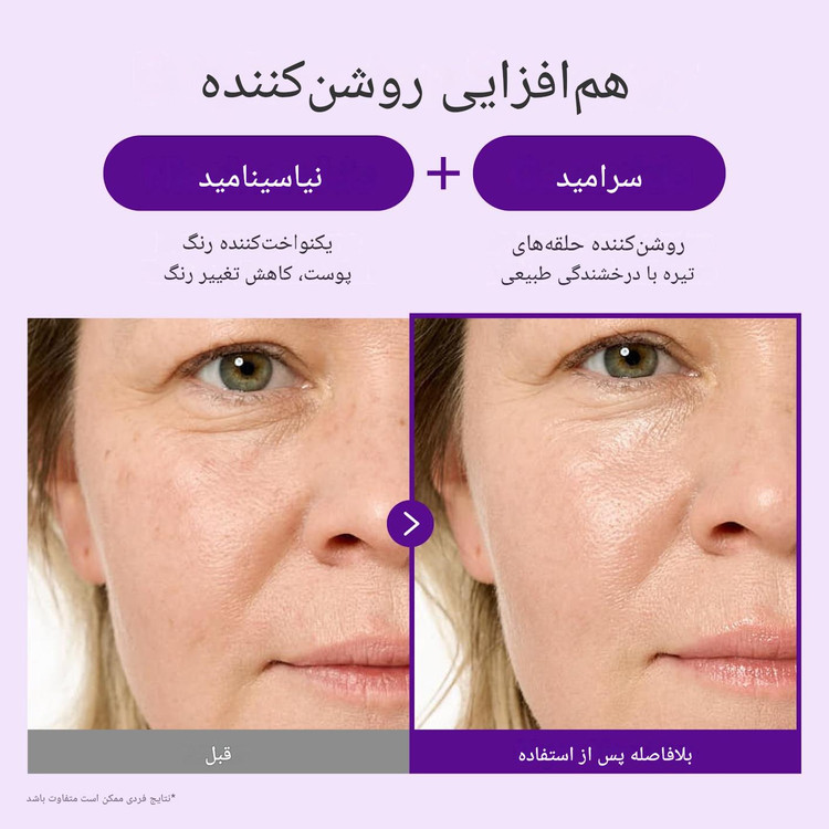 کرم دور چشم نامبوزین حاوی NAD+ رتینال و ۵۰ نوع پپتاید ضد چروک ۲۰ میل