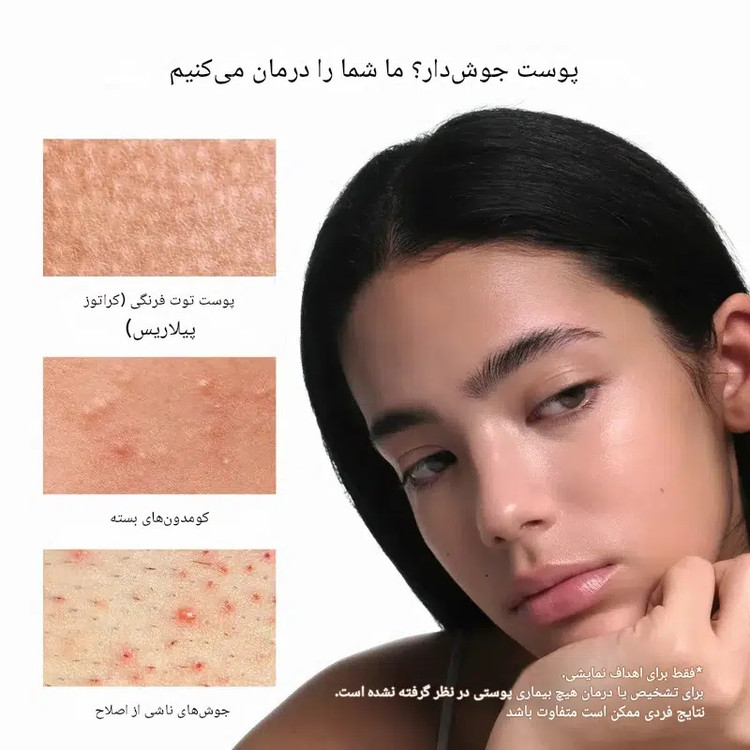 بوستر شات آرنسیا گلیکولیک اسید روشن کننده و لایه بردار و کنترل چربی و ضدجوش حجم 30 میل